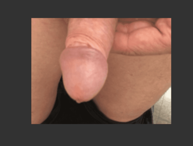 Mittagspause